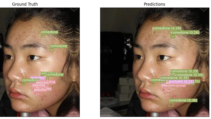 Deteksi Jerawat menggunakan Arsitektur Faster R-CNN dan ResNet50-FPN - jasa machine learning joki machine learning